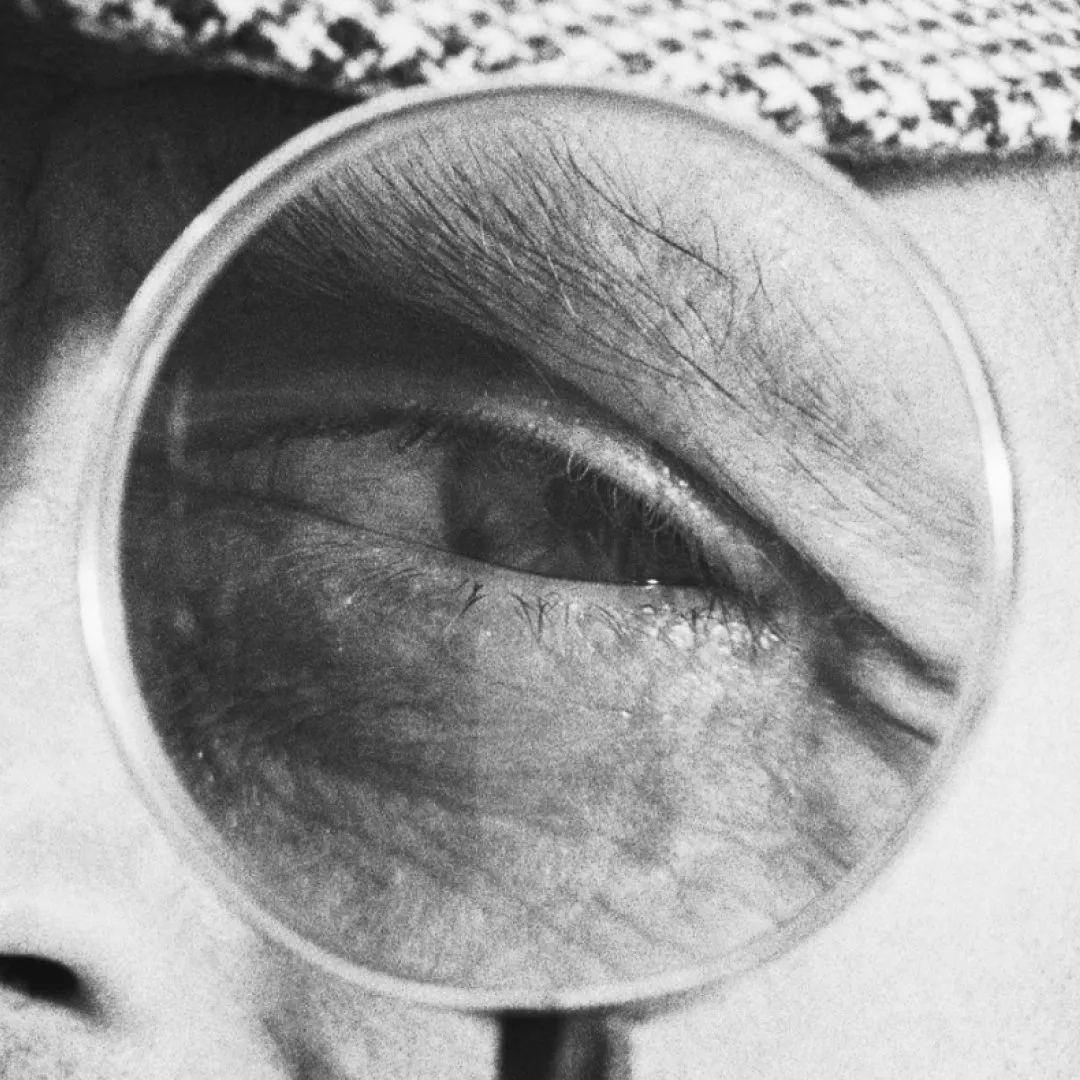 A grainy black-and-white close-up of an eye viewed through a circular magnifying glass.